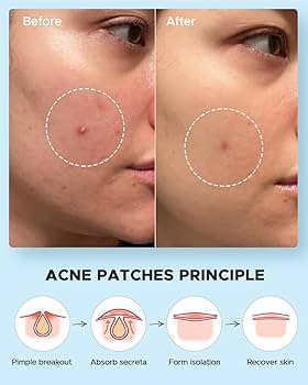 Overnight Clarity Pimple Patches — 240 Count